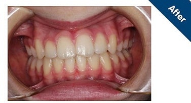 teeth-surgeon-dentist-in-banjarahills-vistadent-hyderabad