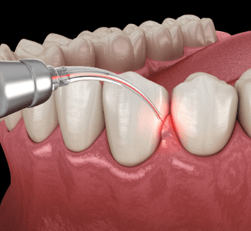 Restorative-Dentistry-At-Vistadent
