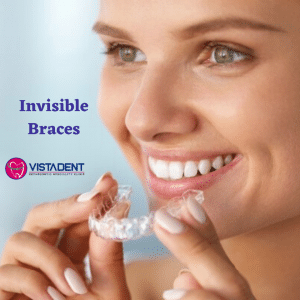 invisible braces in hyderabad