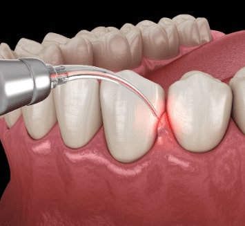 Restorative-Dentistry