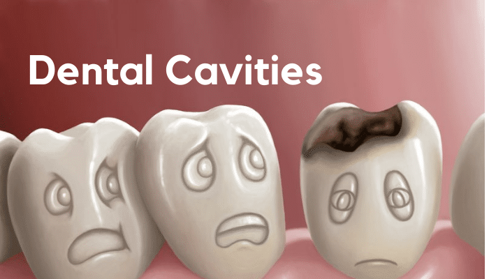 Dental Cavities