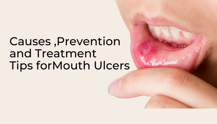 5-common-causes-of-mouth-ulcers-bacchus-marsh-dental-house