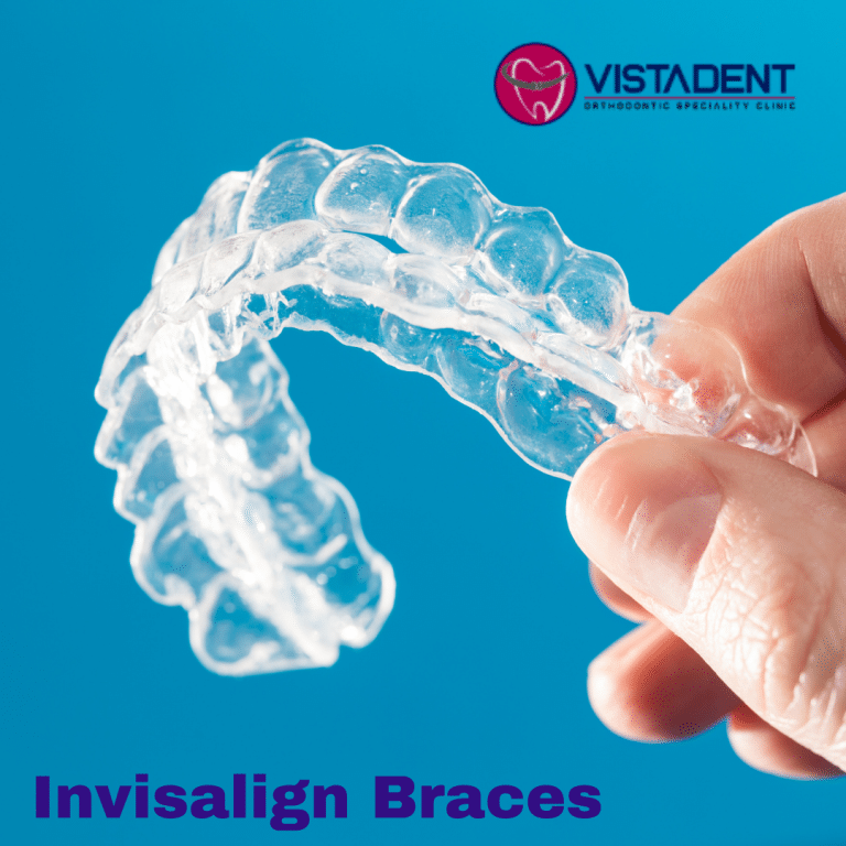 Invisalign Braces Cost in Hyderabad, Banjara Hills Vistadent