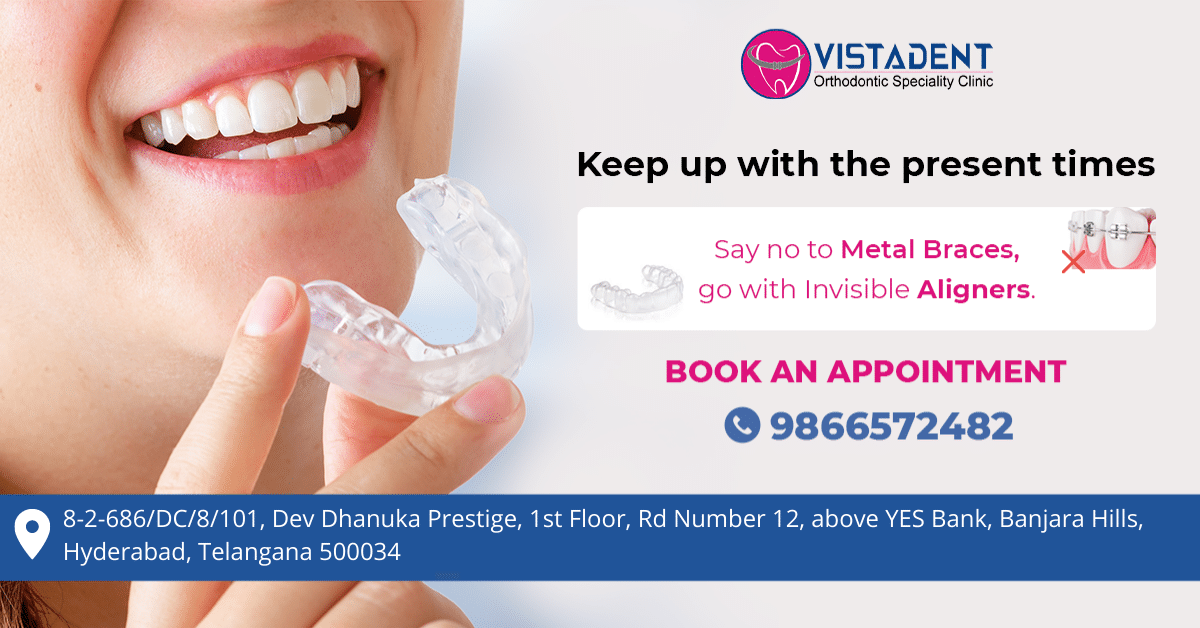 invisible aligners cost in hyderabad