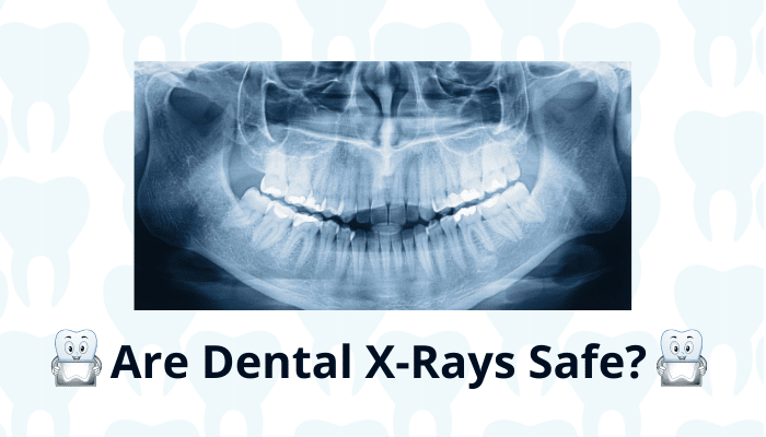 Are Dental X-rays Safe