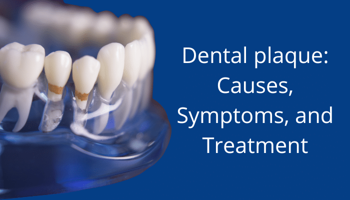 Dental plaque - causes,symptoms and treatment